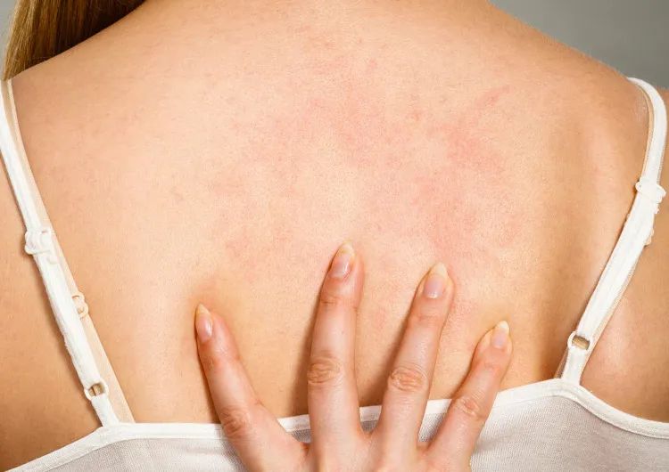 三伏天艾草熏后背多久熏一次,三伏天用艾草泡澡几天泡一次