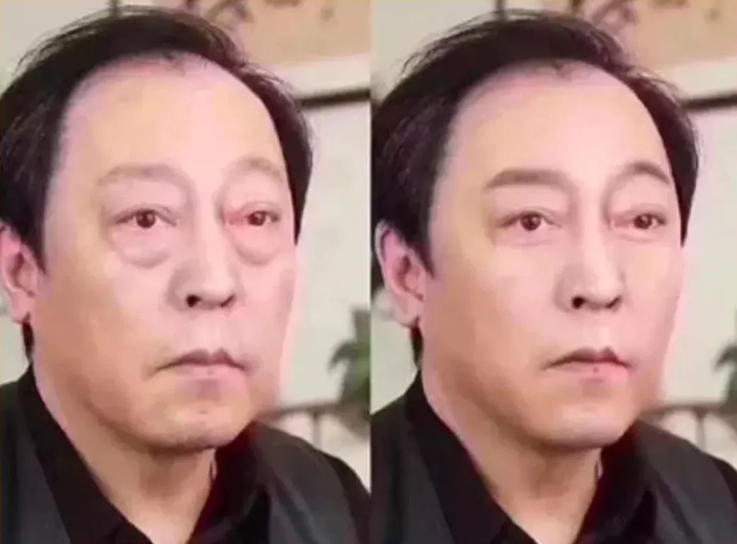 国货眼霜马应龙八宝,马应龙去黑眼霜官方旗舰店