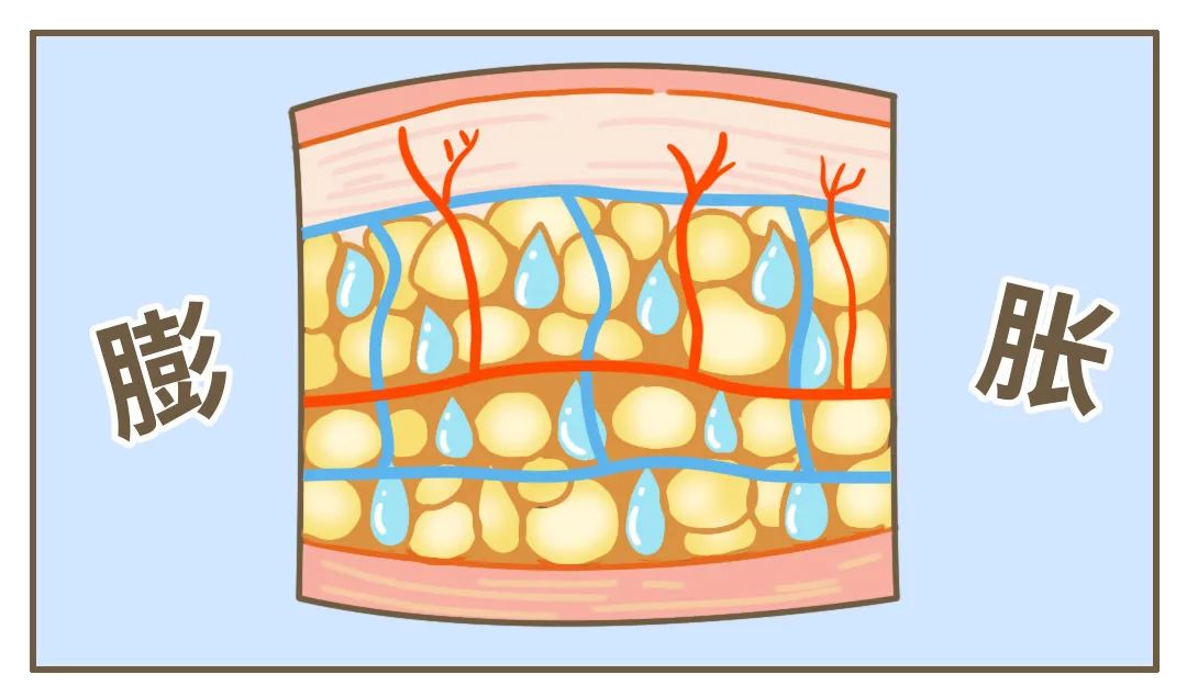 早上起床「胖三斤」，女生为什么那么容易肿啊？?