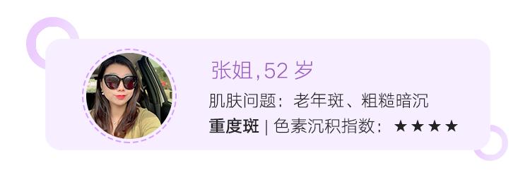 让脸上斑去掉,让脸上的皮肤变白