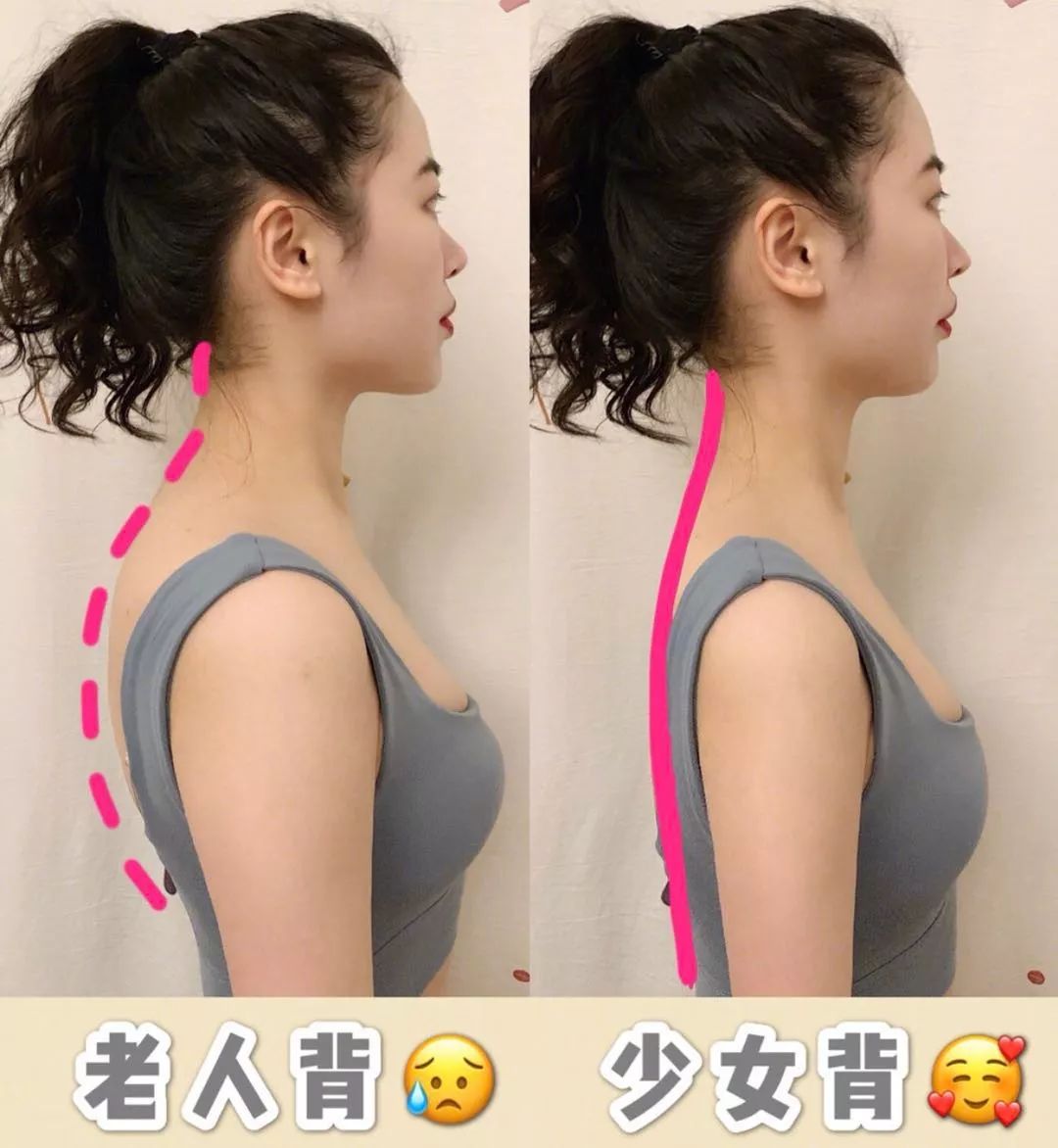 有什么方法可以改善含胸驼背,含胸驼背改善的方法