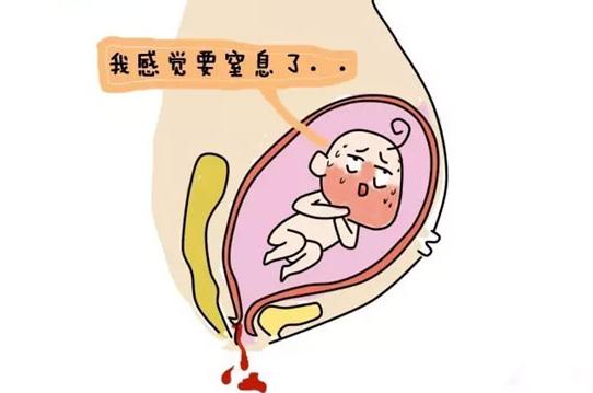 医生怎么判断破没破水,医生怎么看破水了