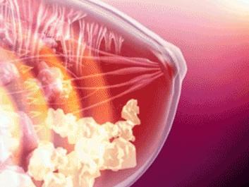 如何快速丰胸且不会反弹,不吃药怎么丰胸