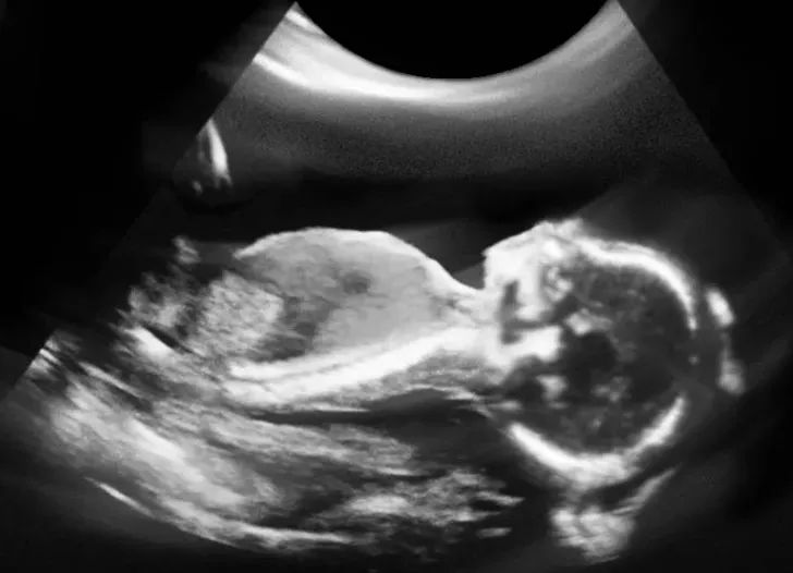 怎样读懂多普勒超声报告单,健康监测体检报告单