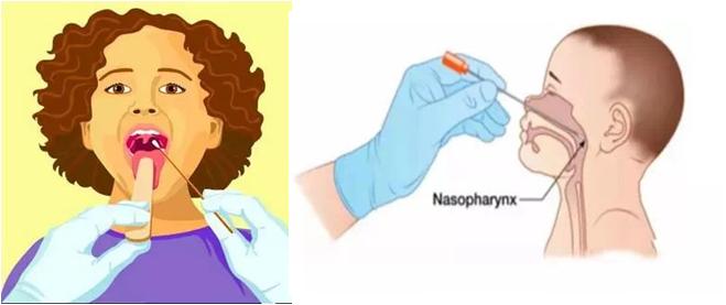 麻麻，核算采样到底痛不痛？