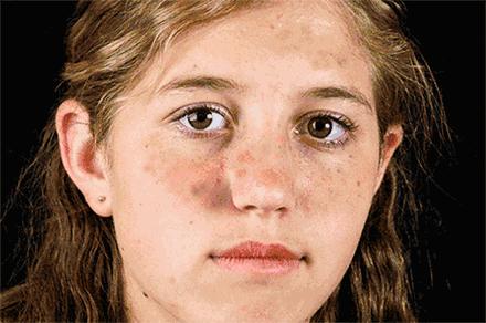 推荐一下你们用过的最好的祛斑霜,公认十大最好的祛斑霜