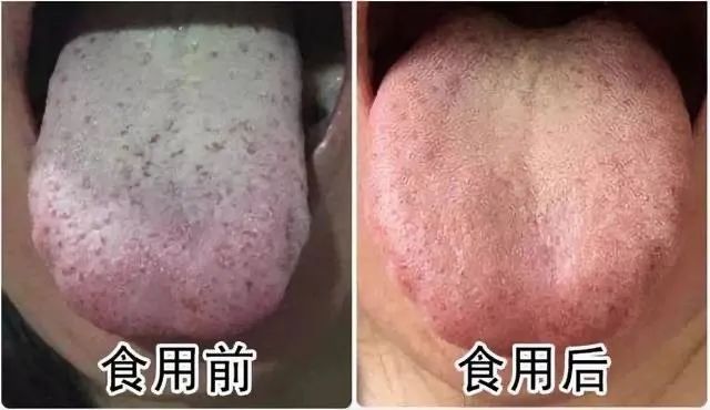 感觉嘴里有股肠胃的臭味,肠胃有一股腐臭味怎么回事