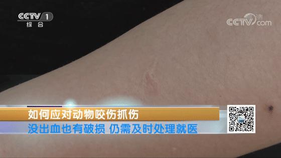 被动物咬伤或抓伤处理方法及顺序,动物抓伤咬伤