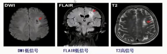 徐运神经内科,徐运医生怎么样