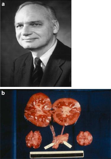 换就有生机!每年30万人在生死边缘排队等候…