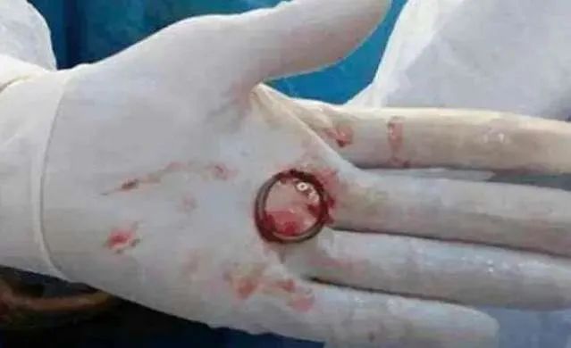 被遗忘的女人沉默杀手完整版,被遗忘的杀手