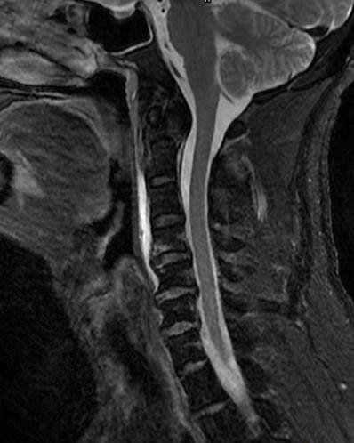 北京友谊医院微创外科,北京友谊医院骨科微创手术