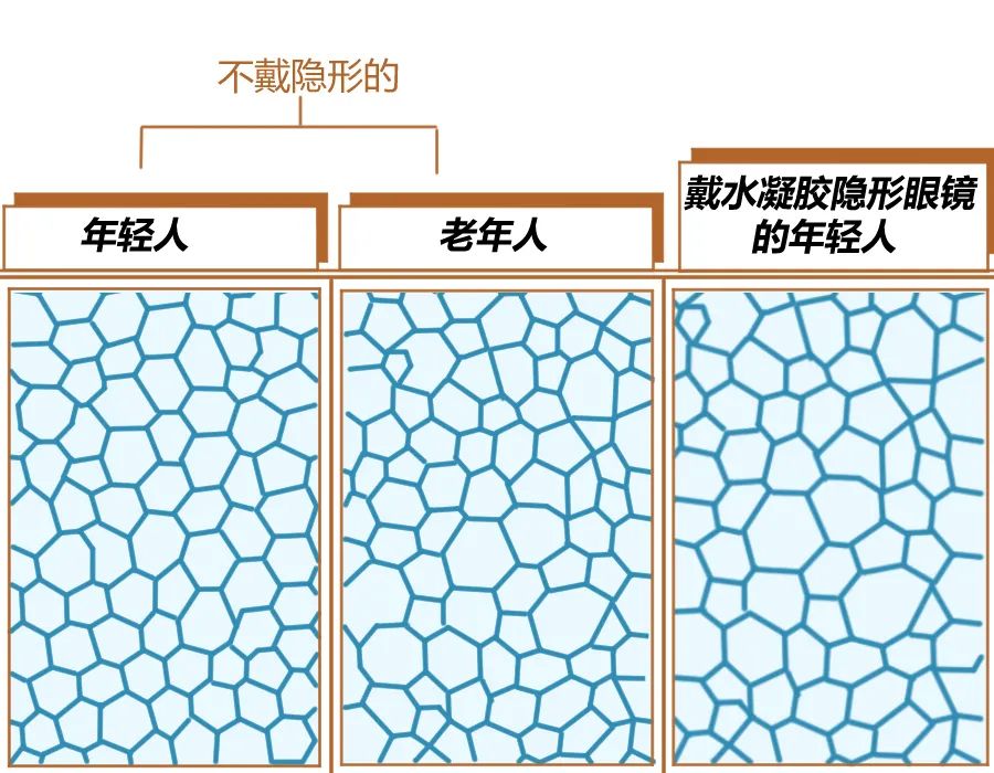 隐形眼镜怎么避免伤害角膜,隐形眼镜不伤角膜