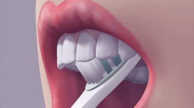 孩子经常刷牙为什么还会蛀牙,天天刷牙怎么还蛀牙