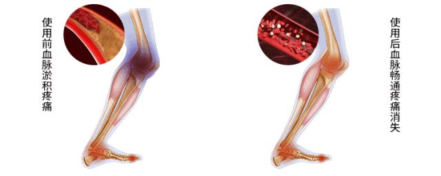 再也不用穿秋裤了！10秒让腿部恒温37度，袪湿又保暖，简直是老寒腿、关节炎的“救星”