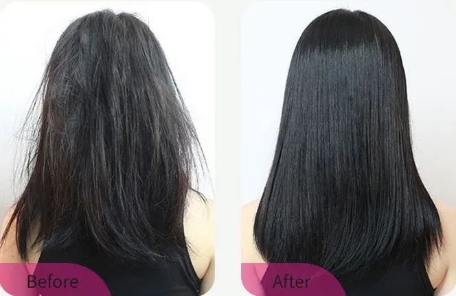 火遍全网的生发养发防脱固发,去屑止痒防脱养发