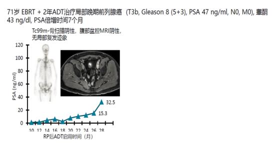 魏强、TOMBAL教授：恩扎卢胺临床数据与实践前沿