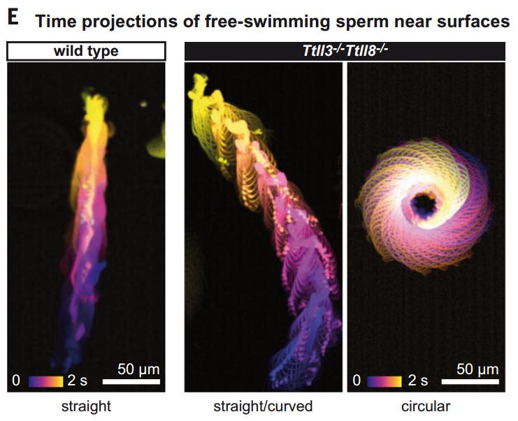 《科学》：精子向前冲的关键发现了！科学家发现，鞭毛甘氨酸化是精子保持直线前进的关键，相关缺陷或与男性不育有关丨科学大发现