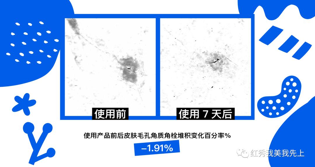 靠精华可以提升紧致吗,精华水可以收缩毛孔吗