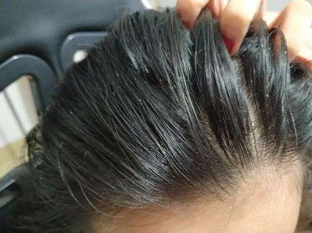 如何洗头更蓬松更柔顺更香,洗头正确步骤能让头发变得更蓬松