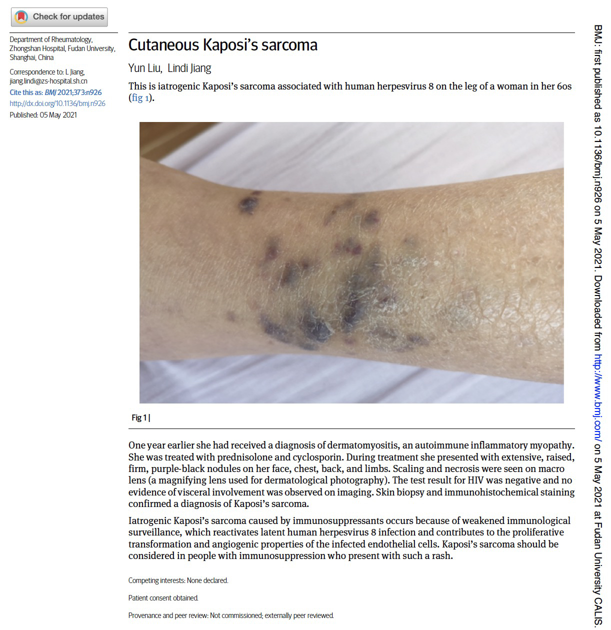 复旦大学附属中山医院风湿免疫科,复旦大学附属医院风湿免疫科