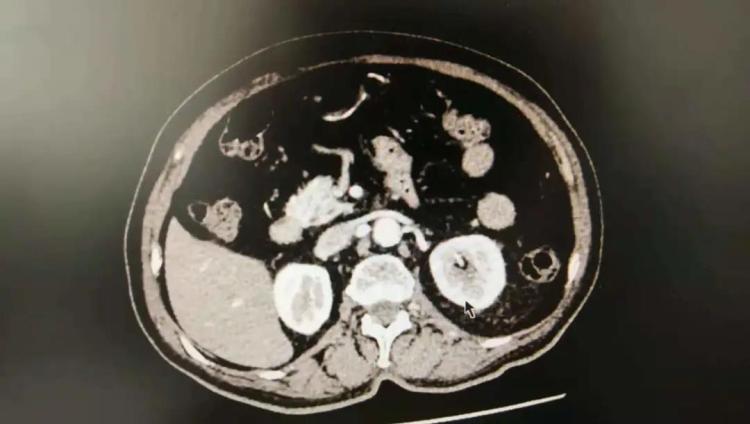 精准治疗高龄患者,精准医疗的治疗方式有哪些