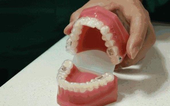 口腔小知识正畸,口腔牙齿科普小知识