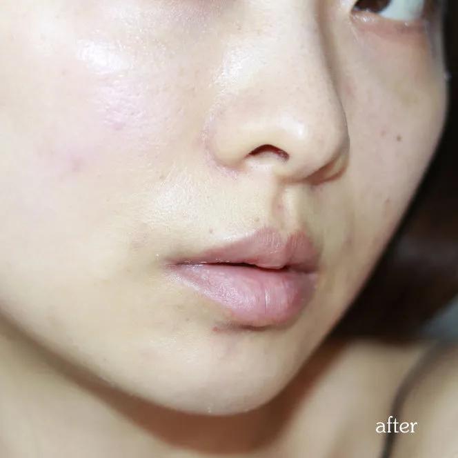 女明星都在敷面膜,出门敷面膜