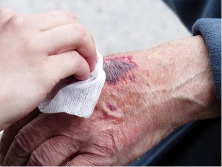 啊啊啊啊啊啊啊流血了怎么办！