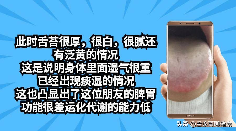 抖音舌诊哥舌象分析与感悟,舌诊歌的分析