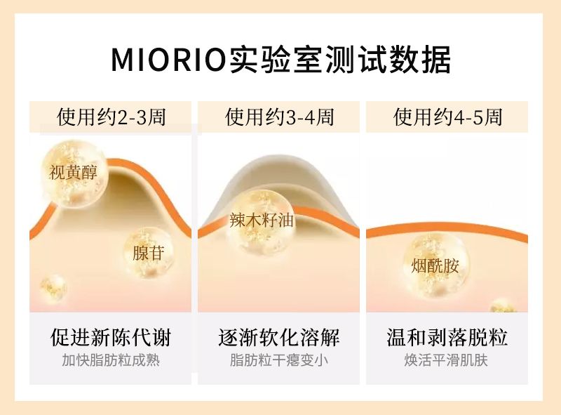 别再用针挑！用米澳拉，脂肪粒自己“掉”下来，效果胜过医美激光