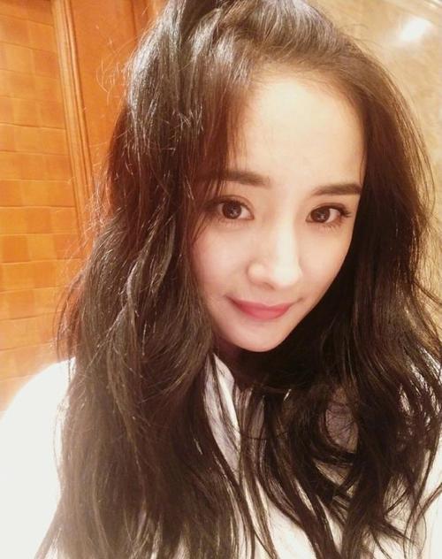 发质偏软m型秃头适合的发型,女生头顶很秃头适合什么发型