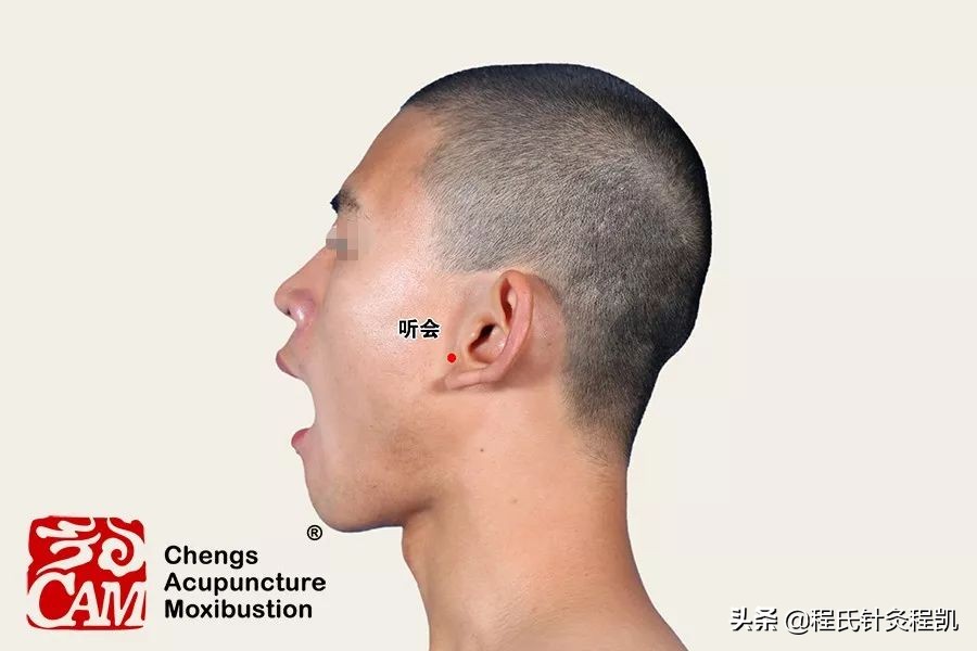 颈椎病引起的耳鸣按摩什么穴位,右耳耳鸣按摩什么穴位视频
