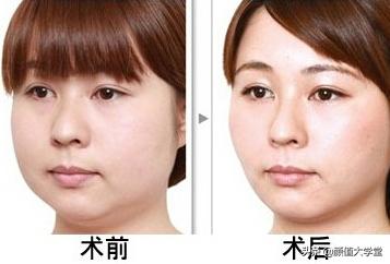 头大脸大的女生怎么办,头大的女生怎么显小