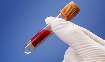 全脂奶粉和纯牛奶减肥,全脂奶和脱脂奶的区别减肥