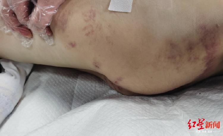 3岁女童遭继母虐待身亡后续,12岁女孩遭继母虐待脑死亡