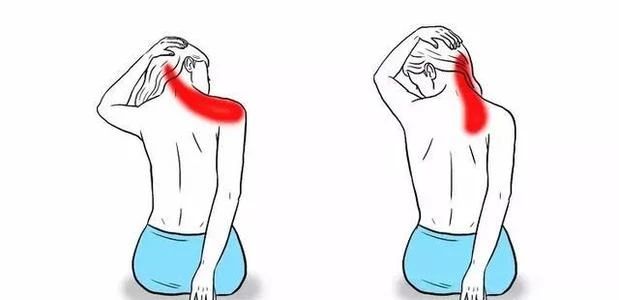 一个动作让你脖子变细,脖子又短又粗怎么办