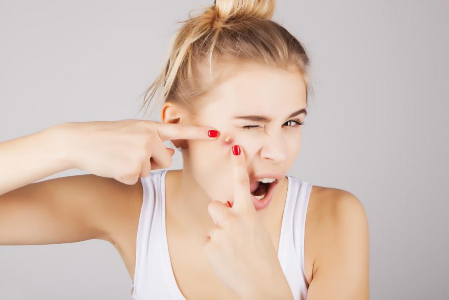 最全面最安全的祛痘小窍门,逆天祛痘的方法