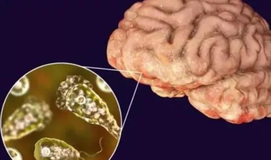 致命的虫子视频,几种最恐怖的食脑变形虫