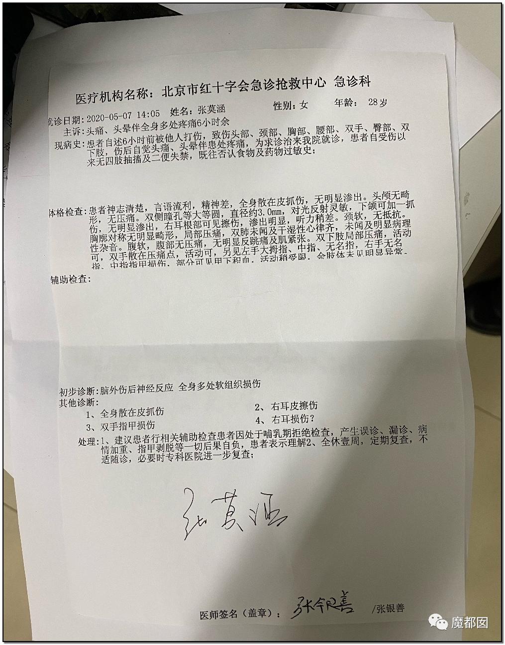 短跑名将张培萌被曝家暴,短跑名将张培萌殴打岳母被行拘