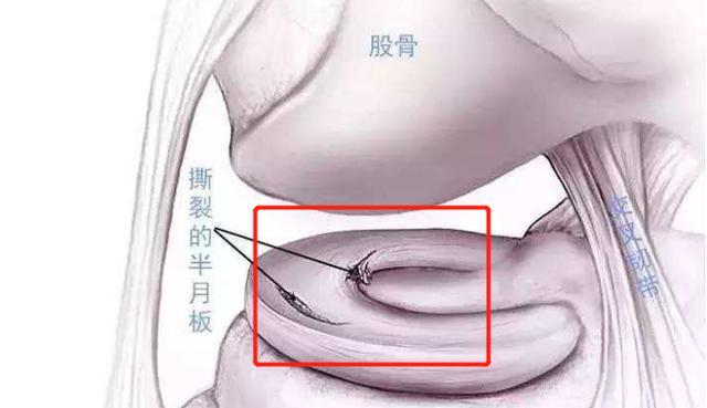 膝盖疼打封闭一般打的什么药,膝盖疼得受不了怎么打封闭
