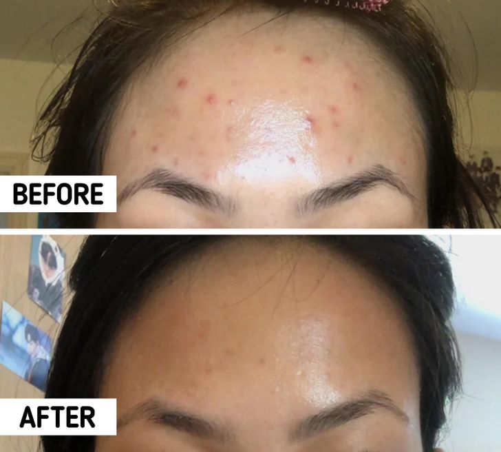 收缩毛孔的方法小妙招,收缩毛孔有效方法小妙招