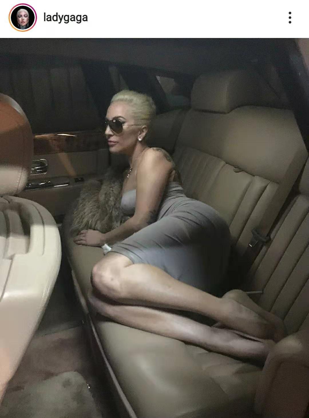 LadyGaga自曝被性侵后患抑郁症，创伤像诅咒，你该如何摆脱？