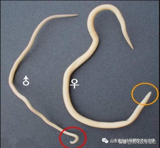 老年人肠胃镜检查,65岁老人胃肠镜检查