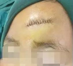 青岛第八人民医院全部科室,青岛第八人民医院皮肤科