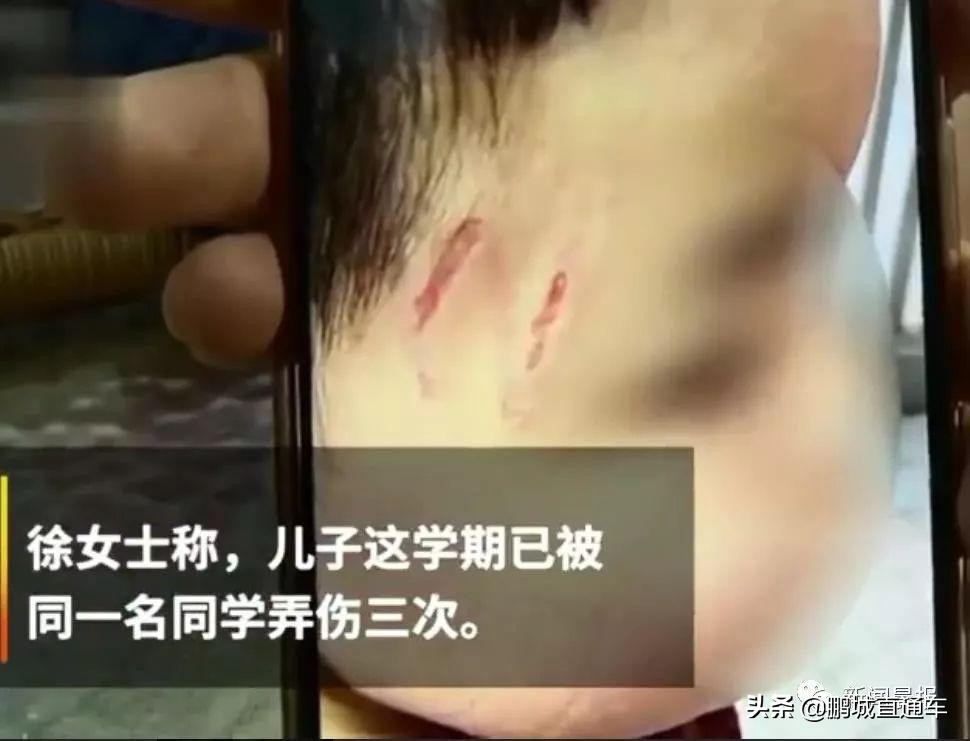 孩子在学校被欺负了找谁,孩子在学校被欺负了应该找谁