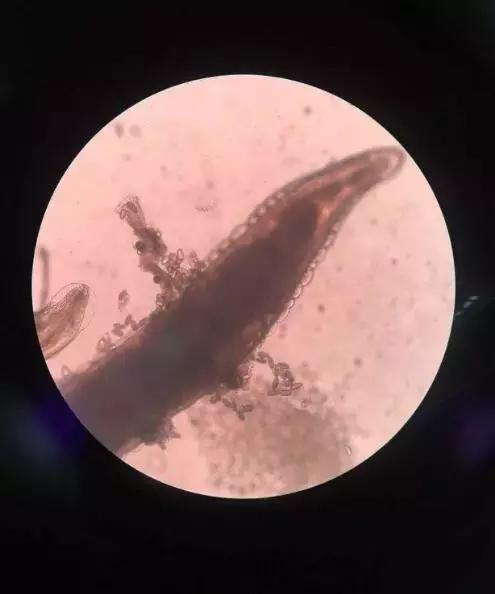 四岁女宝宝说小便地方痒和痛,四岁女宝宝说小便地方痒怎么治疗