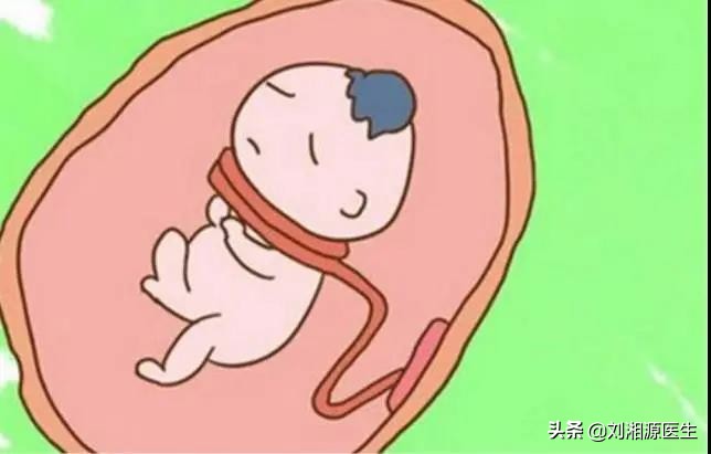 免疫性不良妊娠保胎成功,免疫治疗不良妊娠的方法