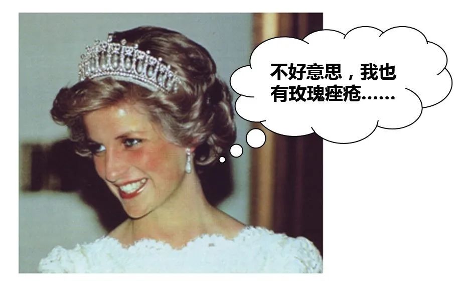 颜值杀手薇尔莉特,常见的影响颜值的皮肤病