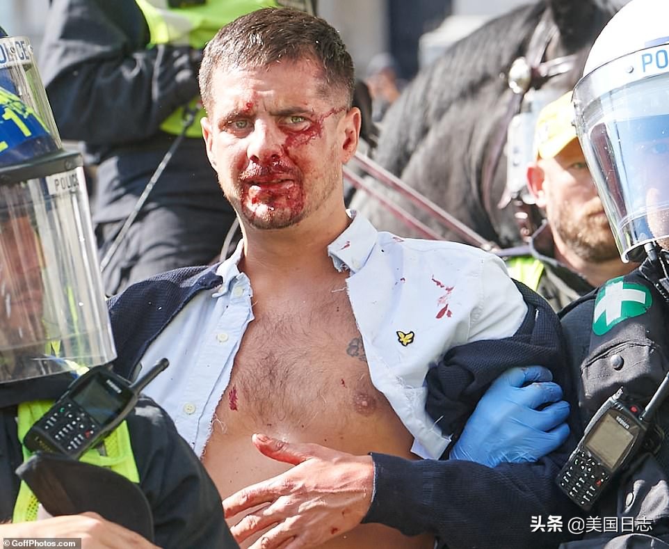 英国抗议人群与警方爆发冲突,英国白人右翼和反种族主义